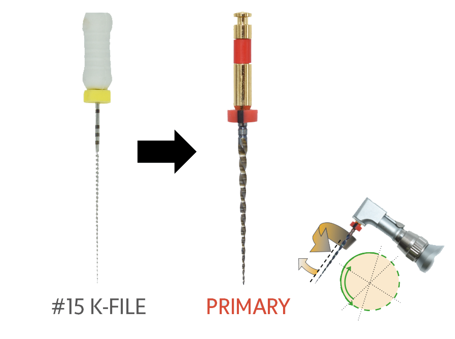 EdgeEndo technical description